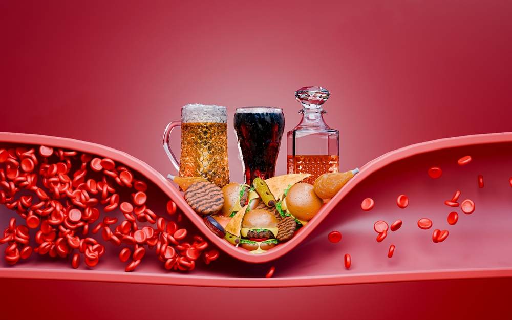 How High Cholesterol Creeps Up Without Symptoms