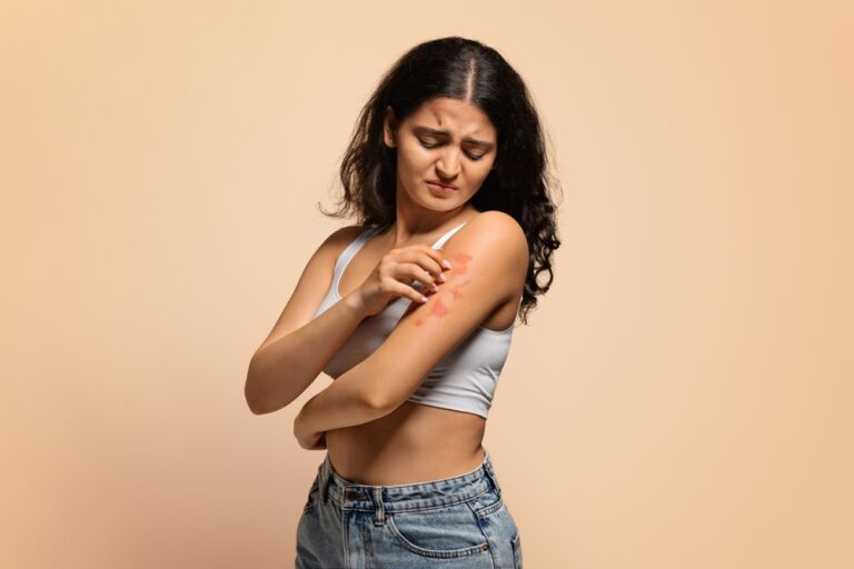 Psoriasis and Eczema Treatments
