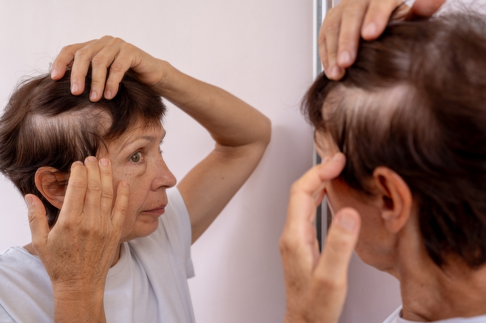 Thinning Hair and Hair Loss